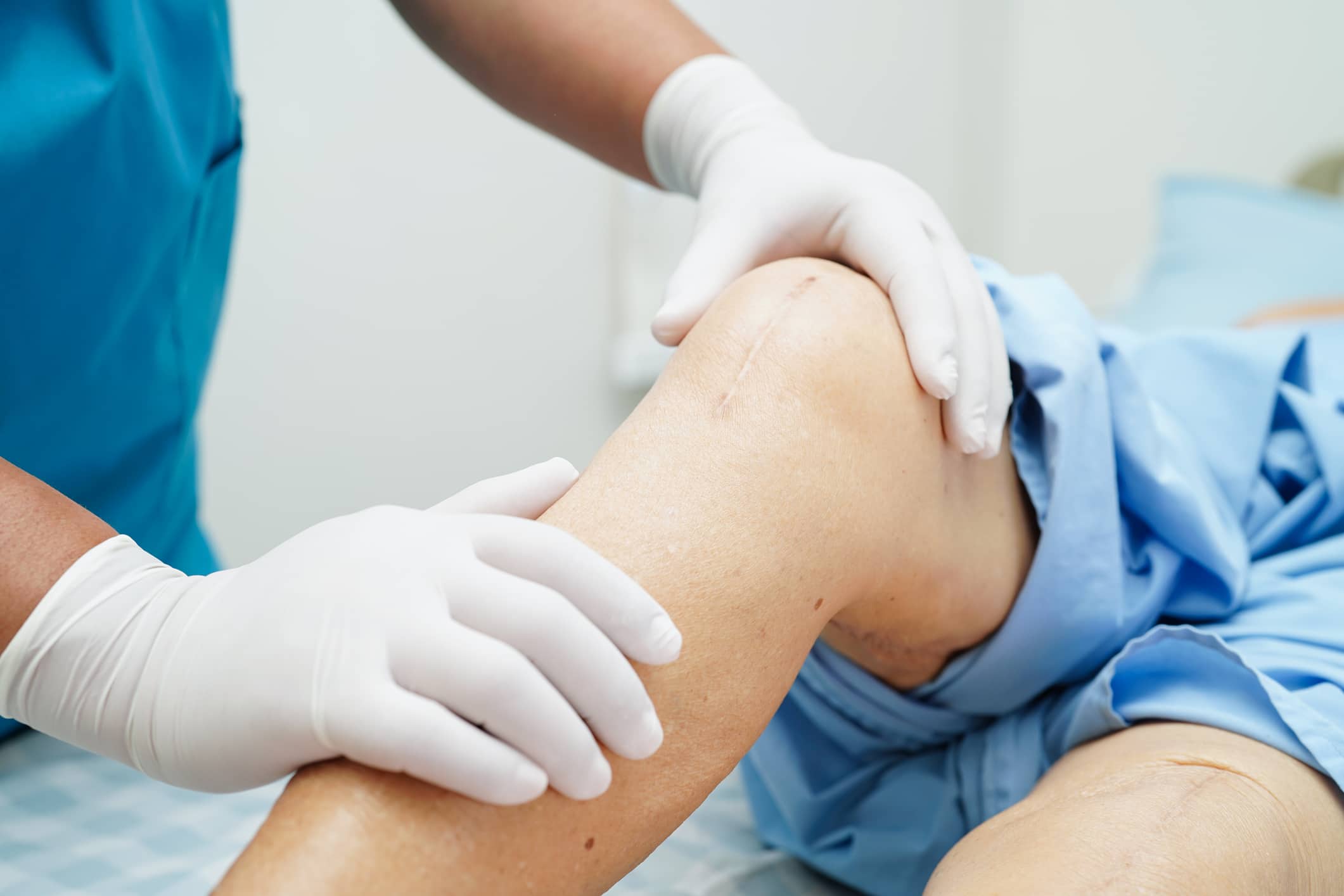 Doctor checking Asian elderly woman patient with scar knee replacement surgery in hospital.